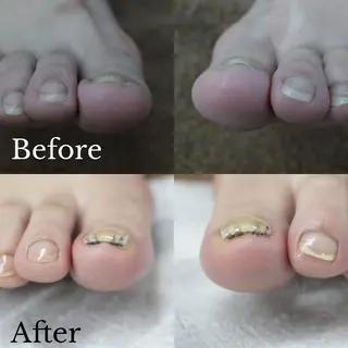 東 あきらのネイルデザイン