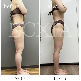 ECXIA 【エクシア】のエステ・リラクイメージ