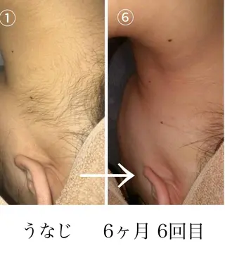 脱毛・眉毛・フェイス サロンN久留米店の眉毛・アイブロウイメージ