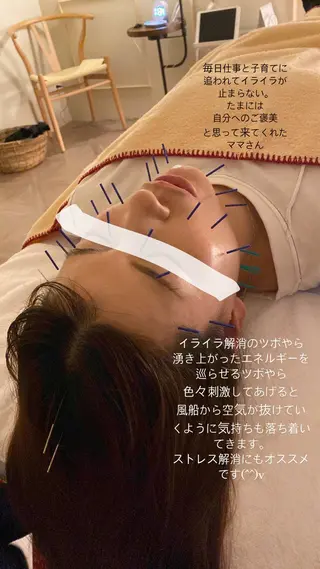 美容鍼/ヘッドスパ/ 💎さかもとのエステ・リラクイメージ