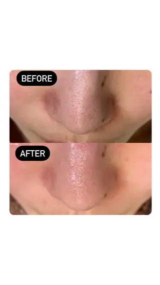 moi-meme 　のその他イメージ