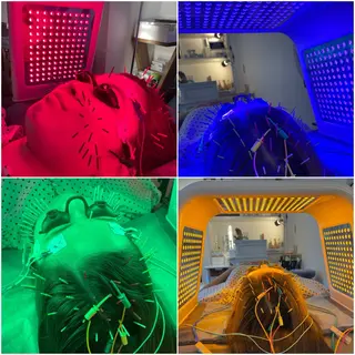 小顔美容鍼専門サロン 渋谷YZのエステ・リラクイメージ