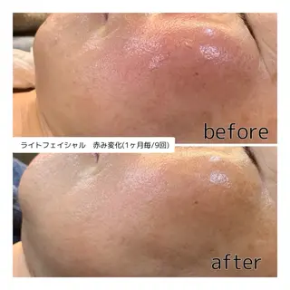 leolo武蔵浦和 肌質改善＆脱毛のエステ・リラクイメージ