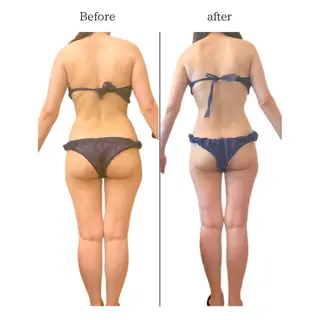 痩身専門サロン Coral✨のエステ・リラクイメージ