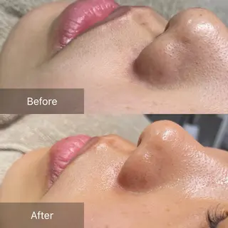 ビューティーサロン Lino🫧mayuのエステ・リラクイメージ