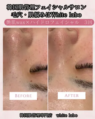 韓国肌管理専門店　White labo 梅田店所属・ホワイトラボ梅田 ｜毛穴・韓国肌管理のエステ・リラクイメージ