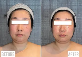 こりとりコルギ専門店MIICO所属・こりとりコルギ専門店 勝　友里奈のエステ・リラクイメージ