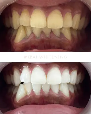 MIRAI WHITENING所属・ミライ ホワイトニングのエステ・リラクイメージ