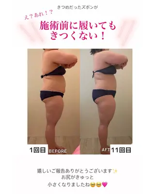 産後ダイエット−9㎏ Pourvous結衣のエステ・リラクイメージ