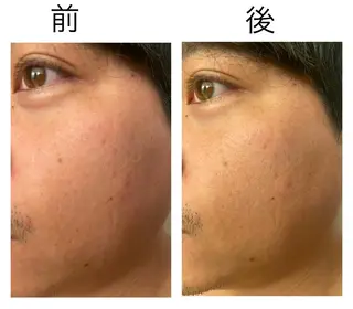 ショート ネイル マツエク・マツパ アイブロウ 小倉 麻由のエステ・リラクイメージ