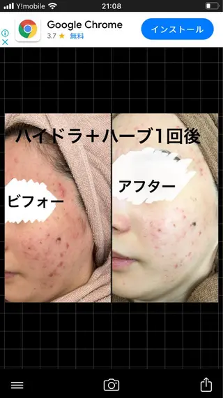 ショート カラー パーマ ヘアアレンジ メンズ キッズ ネイル マツエク・マツパ アイブロウ ハーブピーリング専門 🌿モッカのエステ・リラクイメージ