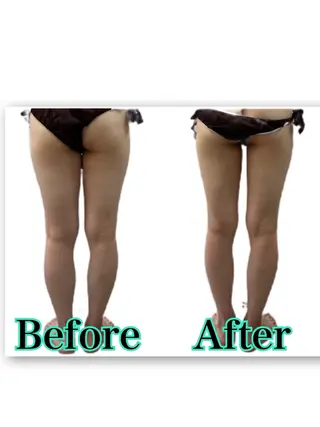 酵素風呂併設/痩身 madokaのエステ・リラクイメージ