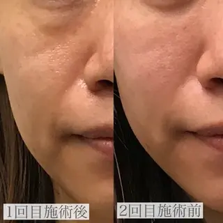 EARTH coiffure beaute 新潟紫竹山店所属・🤍アベシュリ /フェイシャル🤍のエステ・リラクイメージ