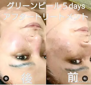 ＤＡＮＫＥ. サポートナースゆうこのエステ・リラクイメージ