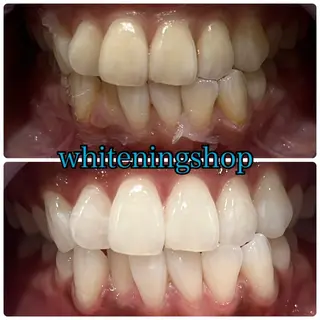 ホワイトニングショップ津店所属・ホワイトニング ショップ津店のその他イメージ