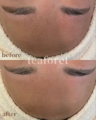 egg tea forêtのエステ・リラクイメージ