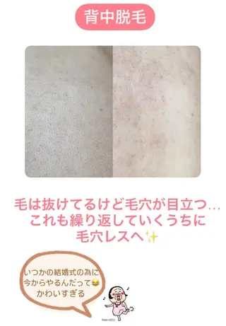 Hit. シュガーリング豊橋のエステ・リラクイメージ