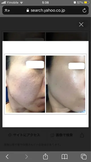 ハーブピーリング専門 🌿モッカのエステ・リラクイメージ