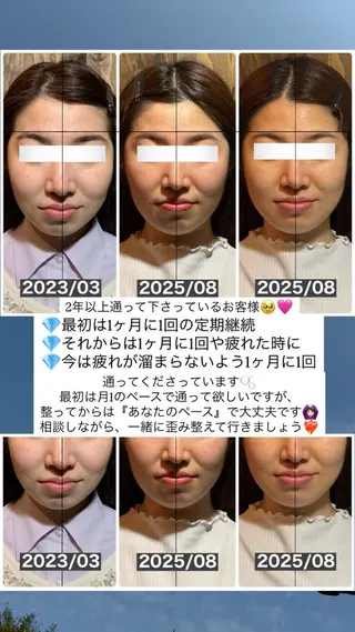 💎後悔させない小顔 矯正💎イトヤマ🌱のエステ・リラクイメージ
