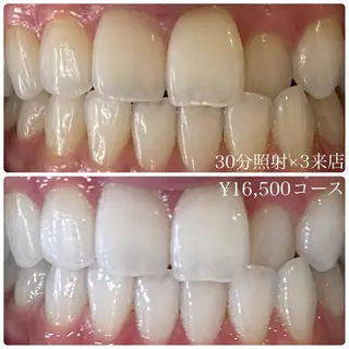 PLATINUM Beauty 横浜店所属・ホワイトニングルーム 横浜店のその他イメージ