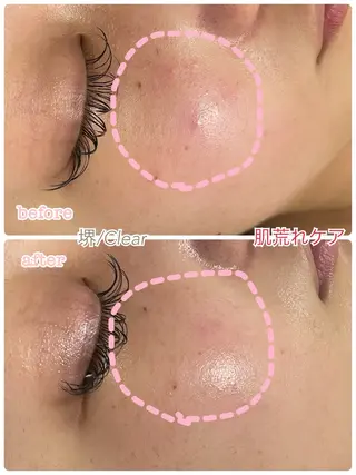 Clear所属・贅沢プライベート サロンClearのエステ・リラクイメージ