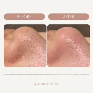 サロンドゥ ルシエルのエステ・リラクイメージ