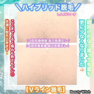 痩身/脱毛/ネイル HARUKAのエステ・リラクイメージ