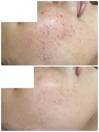 beautysalon  LINO所属・平日限定！お得！ 全メニュ¥5,500のエステ・リラクイメージ