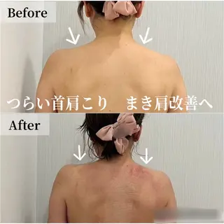 ブライダル痩身×脱毛 尼崎駅前サロンのエステ・リラクイメージ