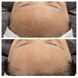 ビューティー ミロワールのエステ・リラクイメージ