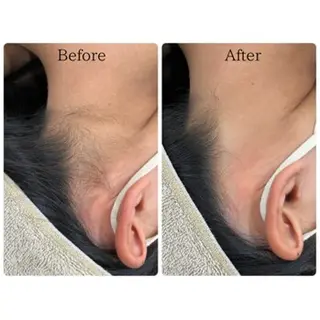 LiLL by Andre beauty所属・LiLL 熊本のエステ・リラクイメージ