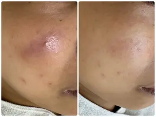 シミ毛穴専門店 yucca(ユッカ)のエステ・リラクイメージ