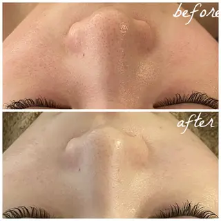 メンズ メナード岐阜茜部 杉浦のエステ・リラクイメージ