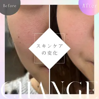 aesthetic éclatのエステ・リラクイメージ