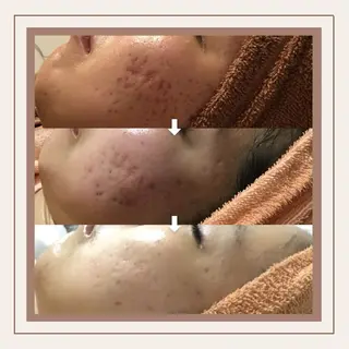 Bébé×DiDiA 野々市市役所前店のエステ・リラクイメージ