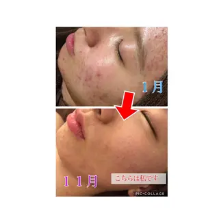 ミディアム カラー パーマ ヘアアレンジ メンズ キッズ ネイル マツエク・マツパ 四つ星サロン🎖 腸＆ニキビケアに特化のエステ・リラクイメージ