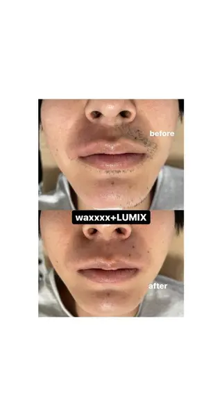 Epina 千葉店 【エピナ】のエステ・リラクイメージ