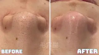 毛穴/毛穴洗浄専門 エミルカ船橋のエステ・リラクイメージ