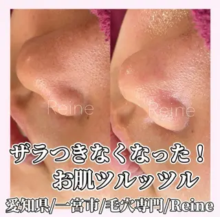Reine BeautySalon所属・毛穴/シミ肝斑/脱毛 横山梨里のエステ・リラクイメージ