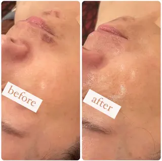 立体小顔×艶肌×美ボ ディ似合わせ施術 岡のエステ・リラクイメージ