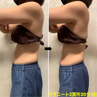 脱毛＆エステサロン【アンリミット】所属・森谷 莉美のエステ・リラクイメージ