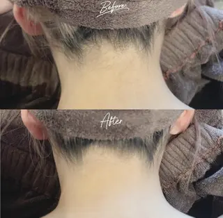 美肌脱毛/肌質改善 《ulula～梟》のエステ・リラクイメージ