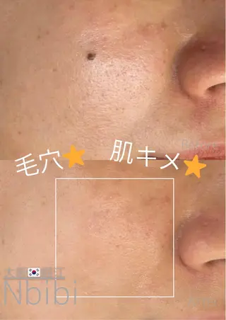 韓国🇰🇷価格 サロン_Nbibiのエステ・リラクイメージ