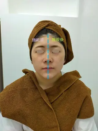 CORAL湘南平塚店所属・【小顔・美容専門】 🐠リカのエステ・リラクイメージ