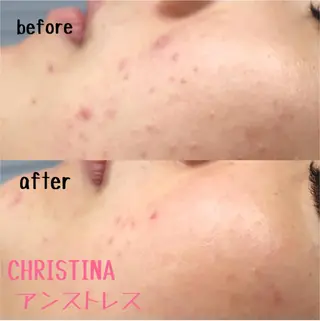 肌質改善サロンChouChou所属・肌質改善サロン chouchouのエステ・リラクイメージ