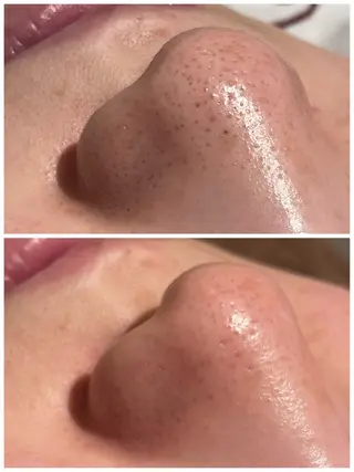 ゆめタウンはません フォルチェ田上のエステ・リラクイメージ