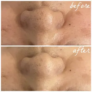 メンズ メナード岐阜市茜部 杉浦のエステ・リラクイメージ