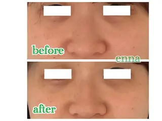 三上 笑里奈のエステ・リラクイメージ