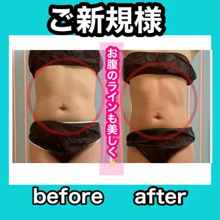 痩身/脱毛/ネイル HARUKAのエステ・リラクイメージ