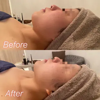 Remina clinical salon所属・ハイフ美肌専門 Remina.c.sのエステ・リラクイメージ